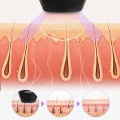 Фотоэпилятор Kitfort КТ-3129
